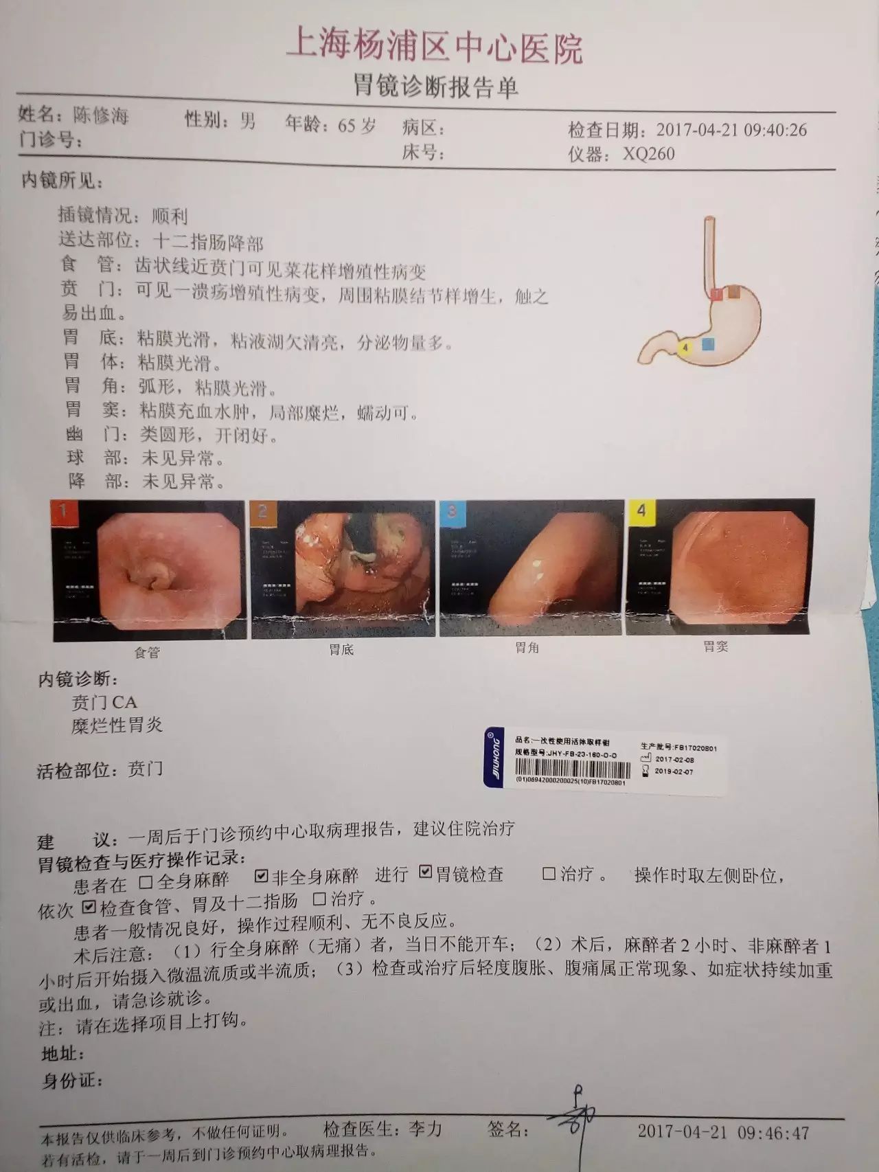 我的爸爸陈修海胃癌晚期治疗全过程