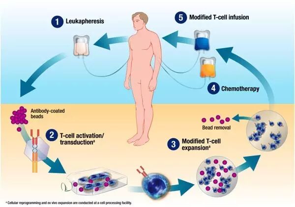 白血病基因改造疗法将上市 女孩治疗后6年未复发