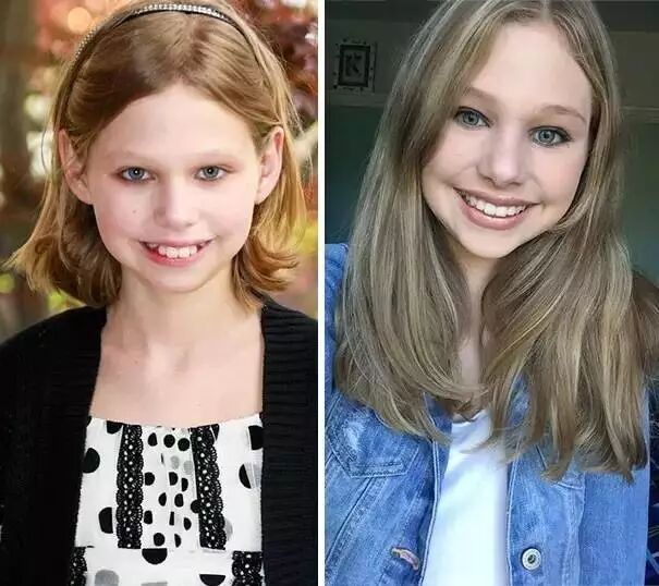 想矫正牙齿，就别听信这些谣言！