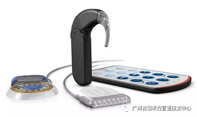 听障宝宝植入人工耳蜗后,父母应该怎么做 听障宝宝植入人工耳蜗后,父母应该怎么做