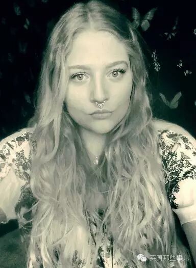 &quot;我太丑了！我活不下去了！&quot; 20岁她3次尝试自杀