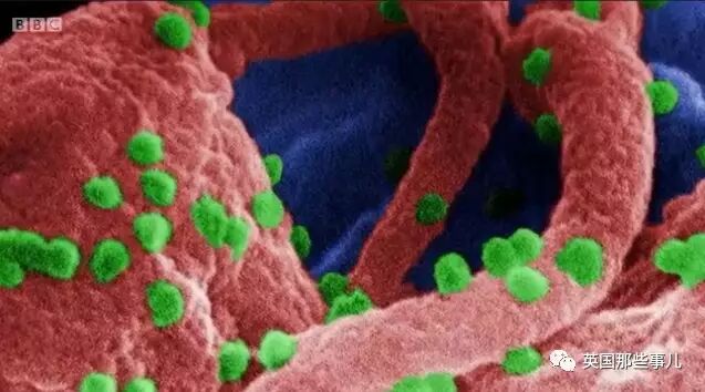 丧心病狂：把患艾滋病囚犯的血,注入上千孩子体内