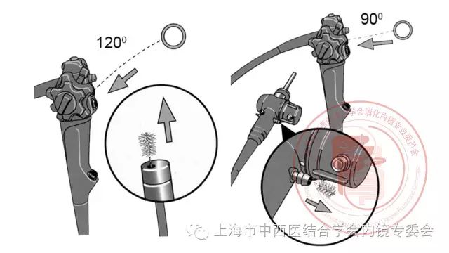 ②抬钳器副送水管道:通过副送水管道对十二指肠镜等抬钳器管道进行