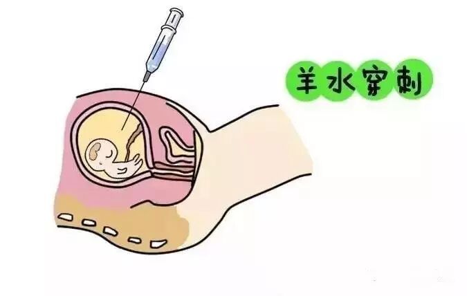 为什么都说羊水是胎宝宝的生命保护水?怀孕期间羊水量多少算正常?-怀孕期