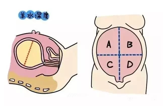 为什么都说羊水是胎宝宝的生命保护水?怀孕期间羊水量多少算正常?-怀孕期