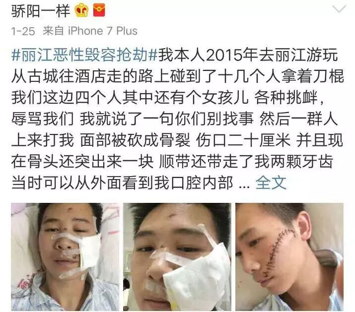 連曝3起打游客事件!麗江要求旅游業(yè)