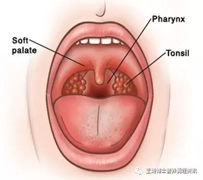 99%的人都不知道咽炎危害这么大！这样做就能预防！