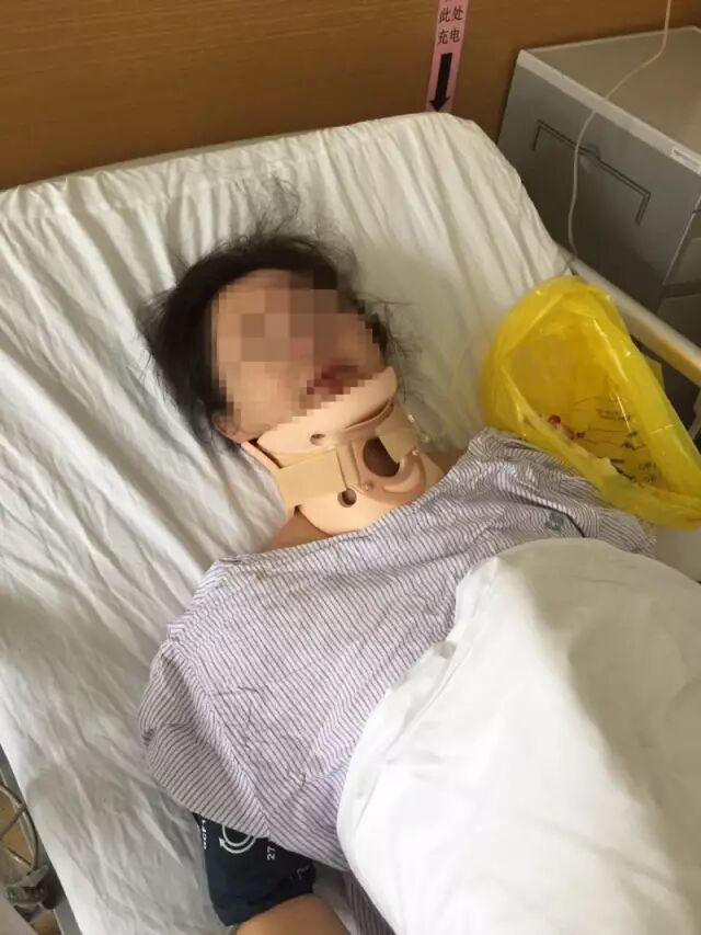 女子骑共享单车 结果刹车失灵撞上柱子摔成重伤