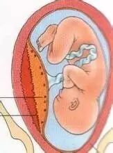 二胎妈妈,又一次挺了过来……(固始孕妈们值得一看! )-怀孕期