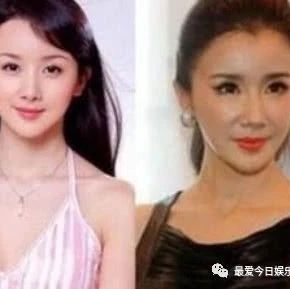 星途一片光明,却因整容自毁前程的女明星,网友:图5可惜了