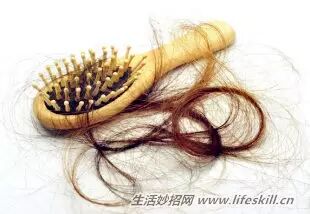 掉头发原因及治疗方法