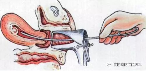女人这事做多了,想再怀孕生子都是不可能的事情,珍惜身体才是好-怀孕期