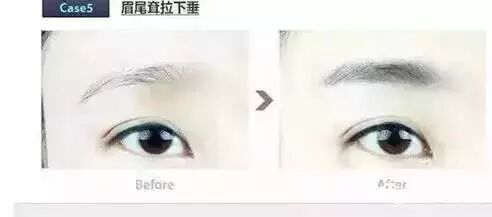 做什么眉形显年轻 自由微信 Freewechat