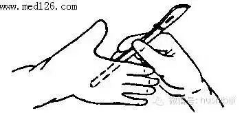 医用缝合扣怎么用珍贵的外科常用手术器械及使用方法(收藏)_https://www.jmylbn.com_新闻资讯_第8张