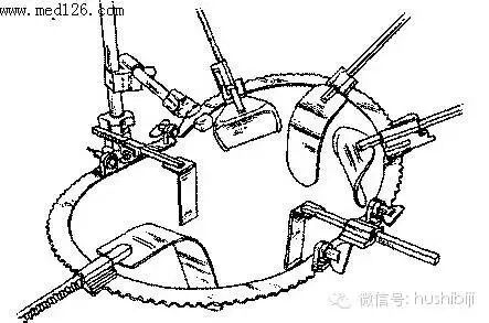 医用缝合扣怎么用[手术频道]外科常用手术器械及使用方法。（聂邯洛医师推荐17-08-10）_https://www.jmylbn.com_新闻资讯_第46张