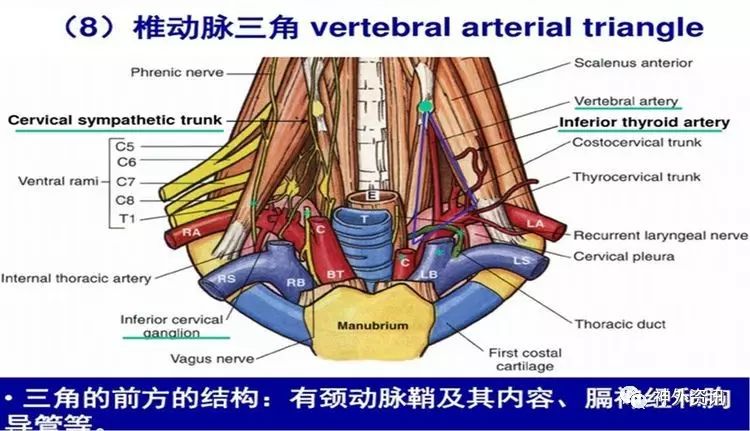 这个是左侧椎动脉三角的解剖:由于左椎开口位置深在,前方有胸导管横