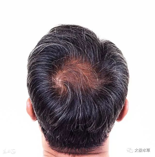 染发可能致癌,中成药"七宝美髯丹"能解决你的白发,脱发问题