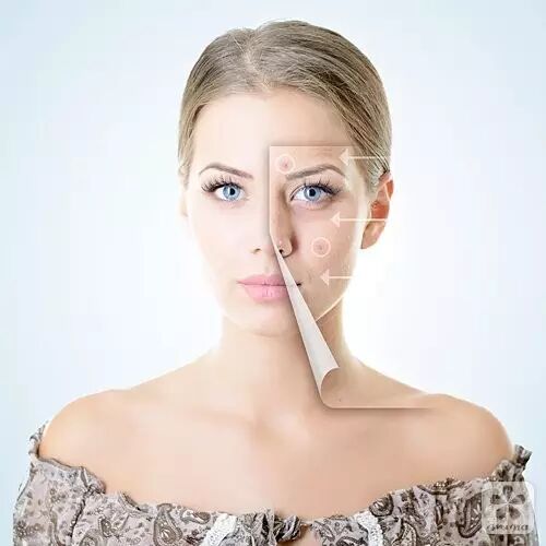 祛痘印疤痕神器