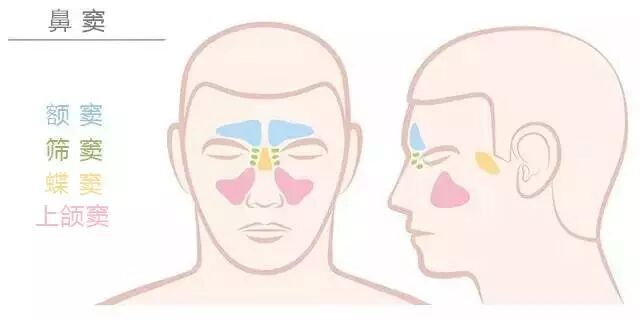 【鼻炎·养护】鼻窦炎不是小病，一定要重视，早发现早调理！