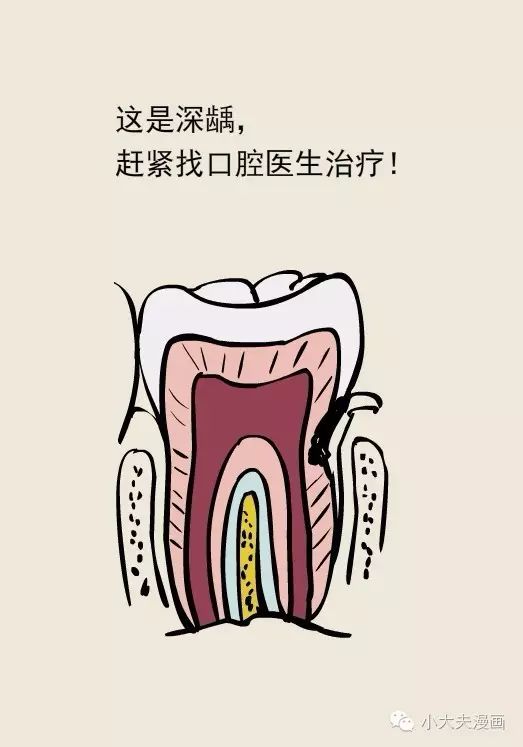 牙疼起来要命,吃什么药救命?