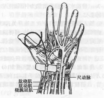于手腕横纹线上针头对向桡动脉血流方向,与皮肤呈 45° 角,针头斜面