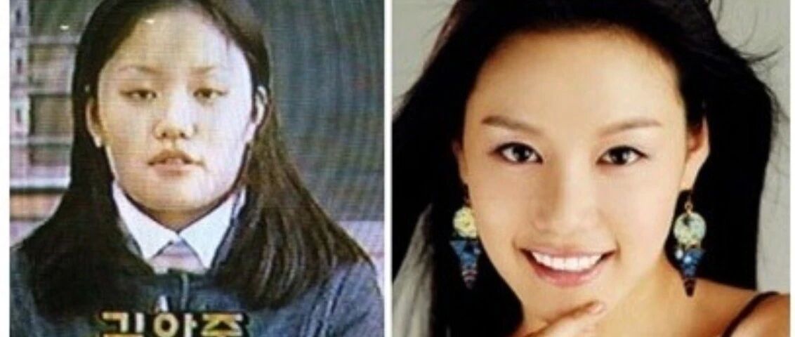 还记得《美女的烦恼》中的金雅中么?女神也是一路变来的~