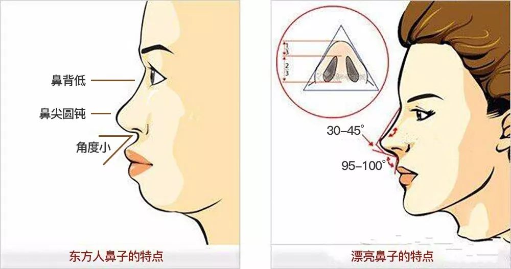 同样是隆鼻,为什么别人的五官更立体,你却依旧扁平脸?