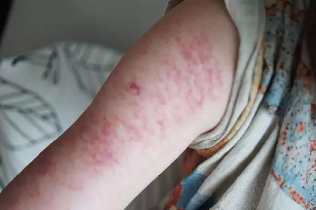 一个朋友晚上吹空调