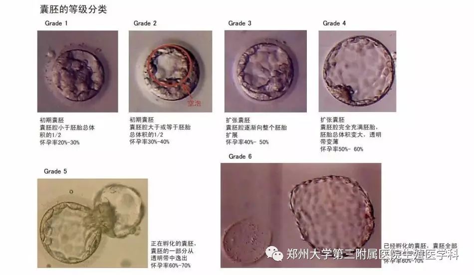 郑大三附院生殖中心:掀起"囊胚"的盖头来