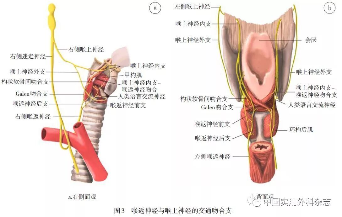 指南与共识甲状腺及甲状旁腺术中喉上神经外支保护与监测专家共识2017