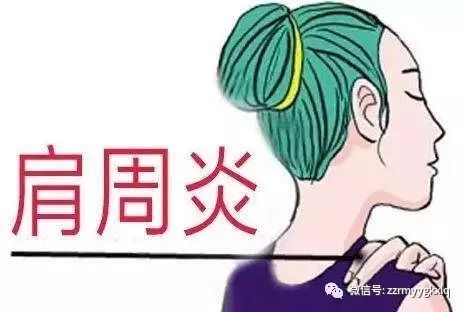 肩关节疼痛大部分不是肩周炎,而是肩袖损伤