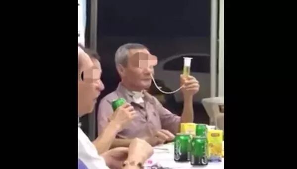 怎么拔鼻腔引流管胃管术（二）_https://www.jmylbn.com_新闻资讯_第55张