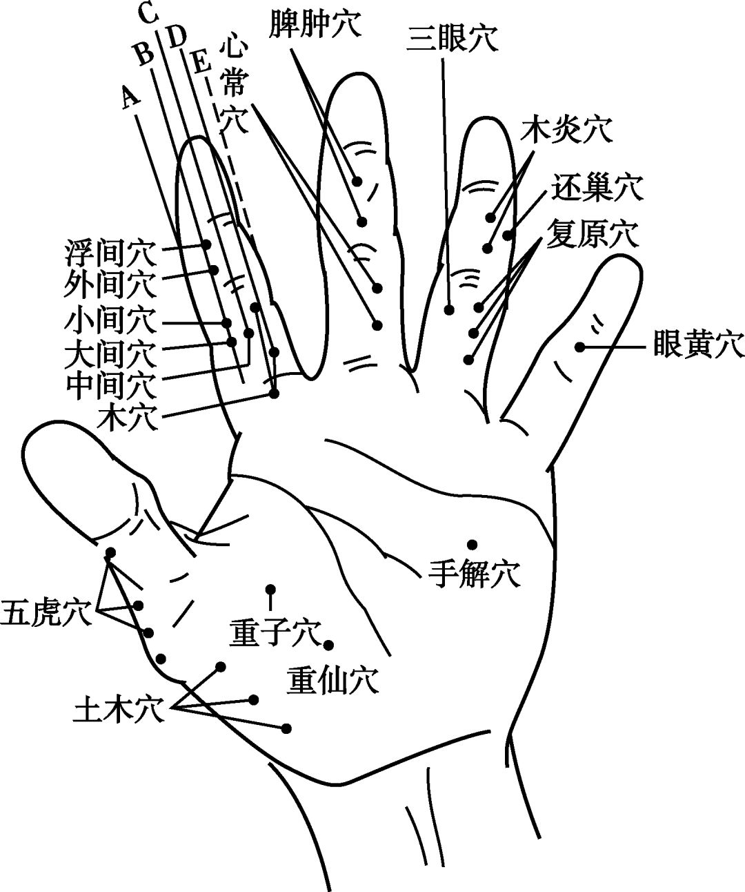 图1-1董氏奇穴指掌部位综览图(掌心)