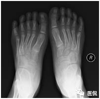 足部骨骼构造_人体骨骼足部_足部骨骼图