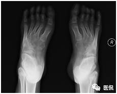 足部骨骼构造_人体骨骼足部_足部骨骼图