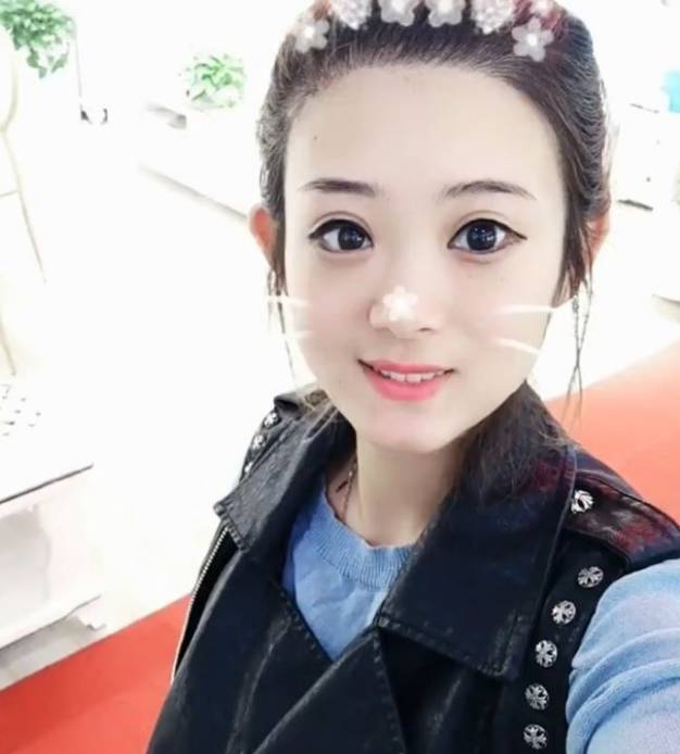 她最像赵丽颖的就是大眼睛,不过有被扒到好像割了双眼皮