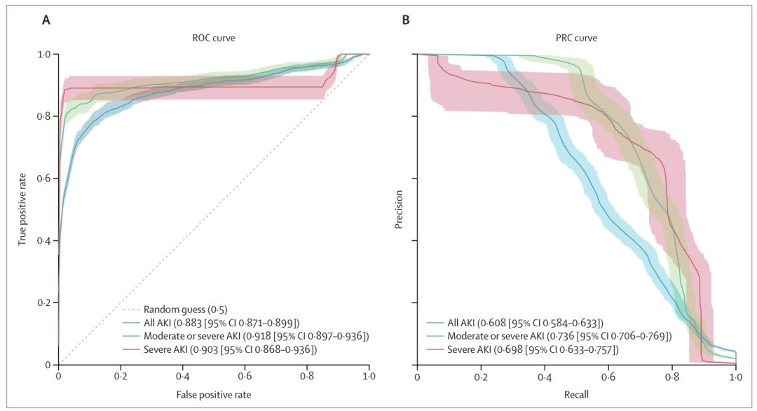 图 4：前瞻性验证 该图展示了 REACT 模型在前瞻性验证中的性能。子图呈现了预测 24 小时内急性肾损伤（AKI）发生风险的受试者工作特征曲线（ROC 曲线）与精确率 - 召回率曲线（PRC 曲线），图中阴影区域代表各性能曲线的置信区间（CI）。