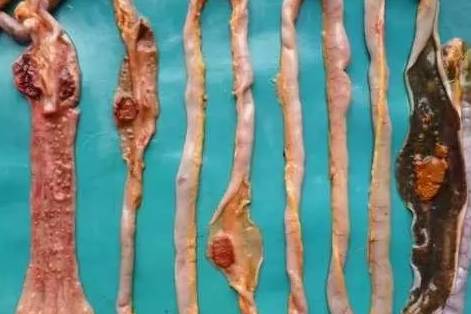 新城疫和流感的辨别