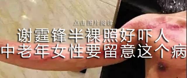 “当时控制不住,清醒后都记得”15岁躁郁症孩子打父母砸家具,恳求妈妈生二胎……