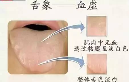 养血妙方玉灵膏补气血助睡眠-古方玉灵膏-食疗补血妙方