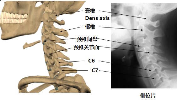 进而发生椎体骨质增生硬化,边缘骨赘形成,黄韧带肥厚及后纵韧带骨化等