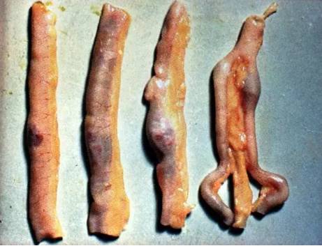 鸡新城疫最全解剖图谱解析