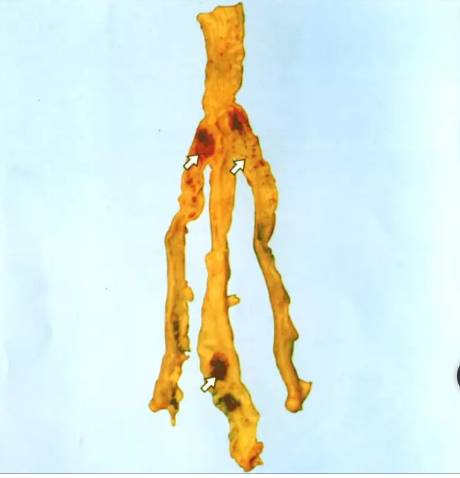 鸡新城疫最全解剖图谱解析