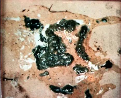 鸡新城疫最全解剖图谱解析