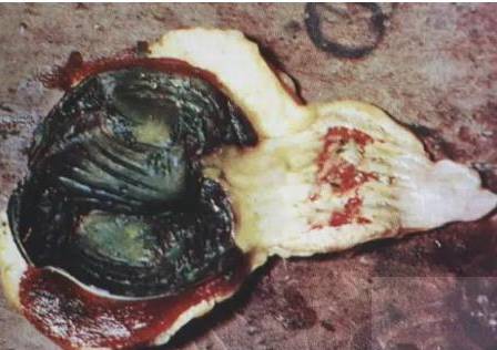 鸡新城疫最全解剖图谱解析