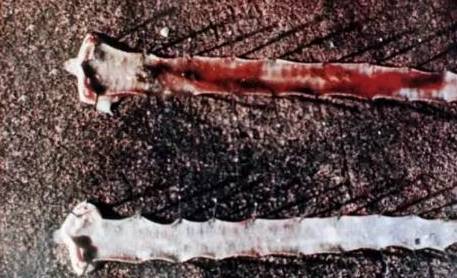 鸡新城疫最全解剖图谱解析