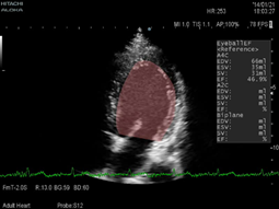 日立彩超怎么样日立超声系统ARIETTA 70、ARIETTA 60_https://www.jmylbn.com_新闻资讯_第5张