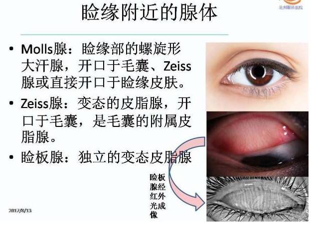 麦粒肿和霰粒肿的个体化分期治疗 (转载)