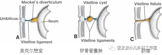 5, 脐茸:如果卵黄管完全闭塞,仅在脐部残留粘膜组织,就会形成鲜红色