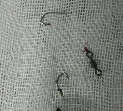 男子吃苋菜直接下咽 结果吞进2个鱼钩卡在咽喉